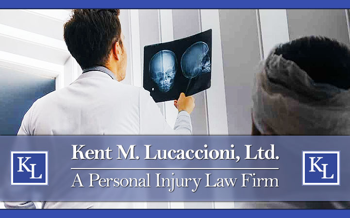 KENT M LUCACCIONI LTD