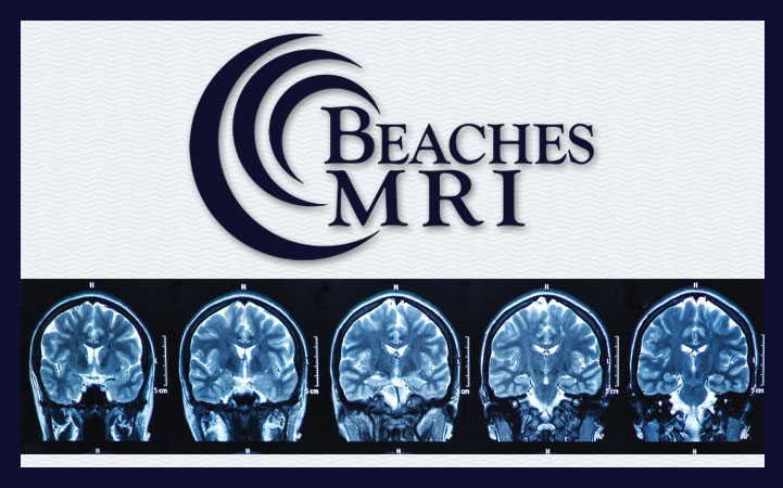 BEACHES MRI