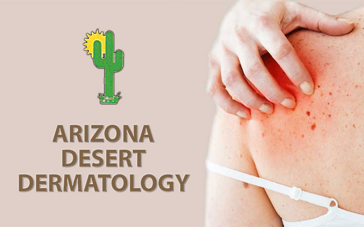 ARIZONA DESERT DERMATOLOGY