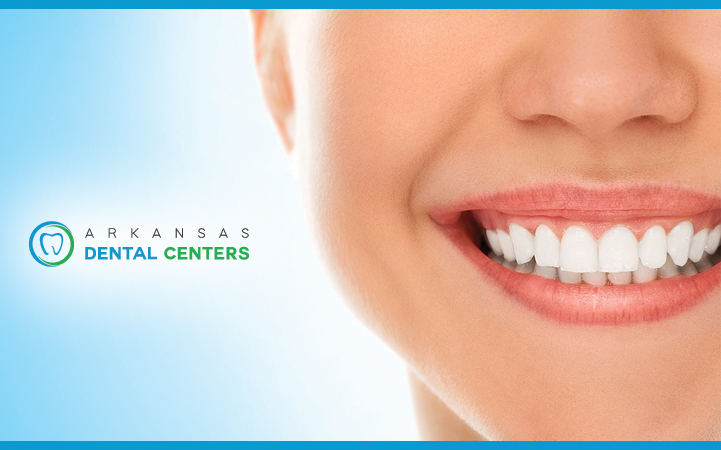 ARKANSAS DENTAL CENTERS - BENTON