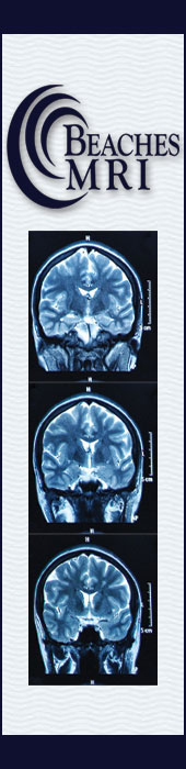 BEACHES MRI